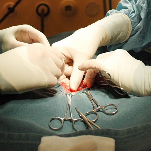 Kirurgisk stress kopplas till vävnadshantering