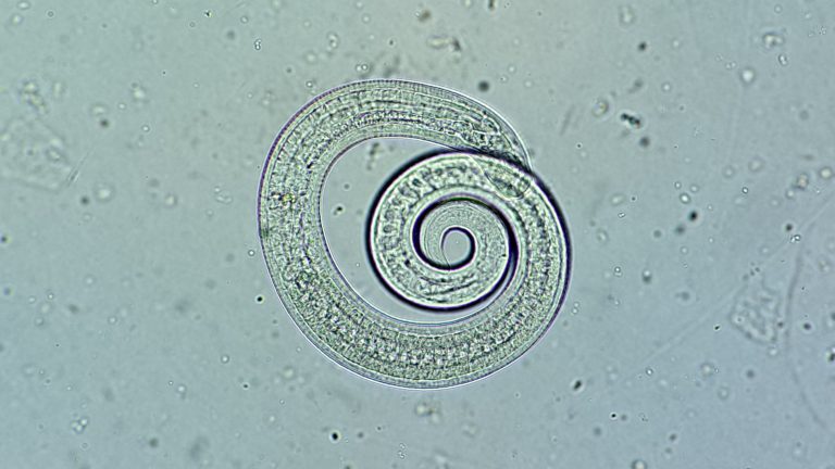 Årets första fall av trikiner påvisat i vildsvin i Stockholms län